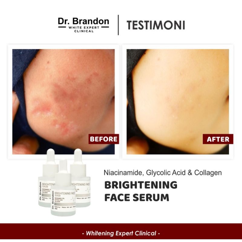 Serum Dr.Brandon Brightening Face Serum Niacinamide 10%