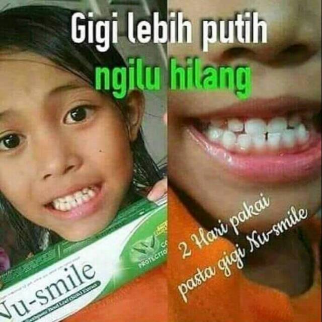 NU-SMILE pasta gigi