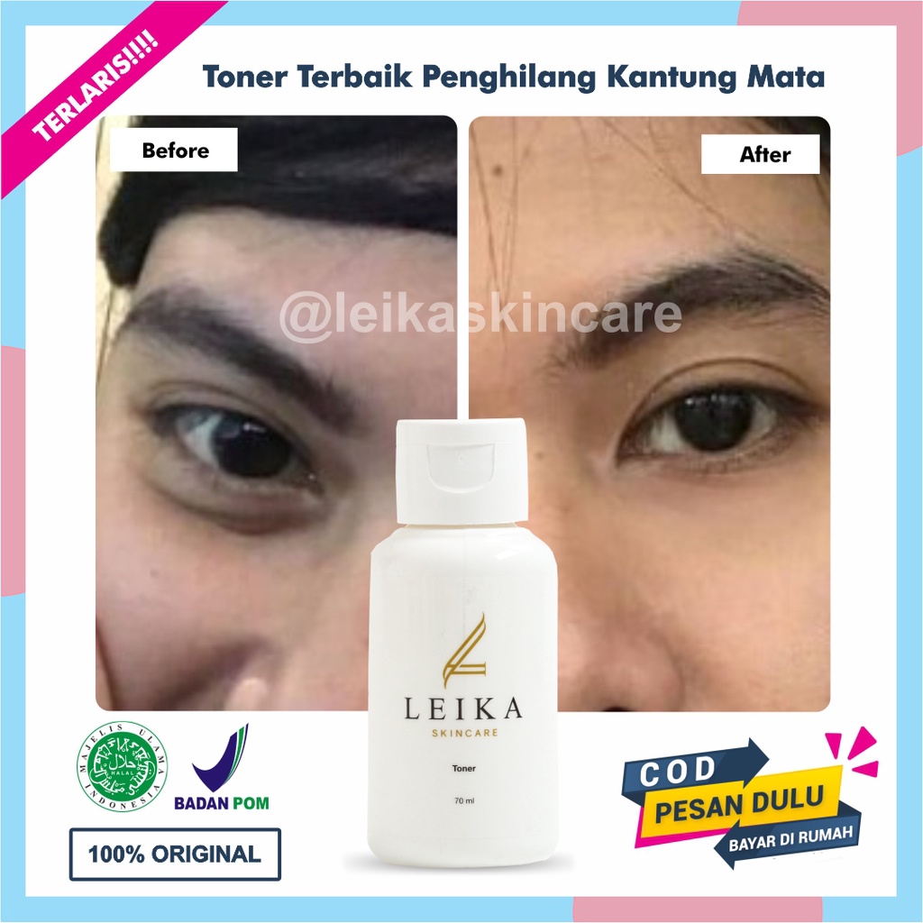 Toner Penghilang Kantung Mata Aman BPOM Halal MUI Penghilang Kantung Mata Terlaris Ampuh Permanen To