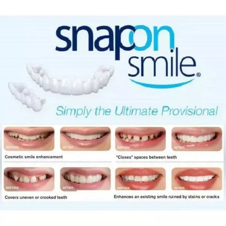 DBI - SNAP ON SMILE SEPASANG GIGI PALSU SILICON 1 SET ATAS BAWAH