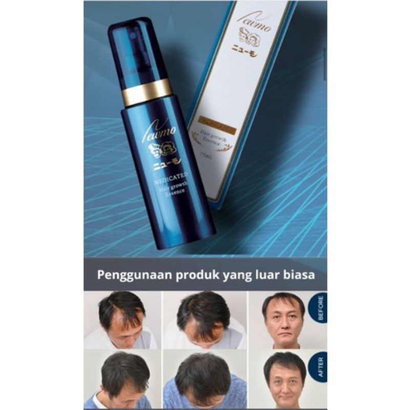 Newmo serum rambut penumbuh rambut mengatasi kebotakan rambut.