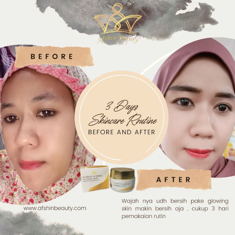 READY GLOWING SKIN SOLUTION , (AGEN SLAWI ) BPOM (ORIGINAL 100%) BIKIN WAJAH GLOWING PUTIH - PENGHILANG FLEK HITAM