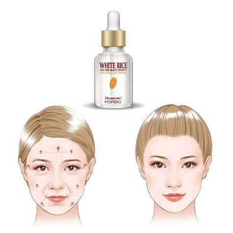 SERUM EHITE RICE ROREC / SERUM BERAS SERUM PEMUTIH WAJAH - ANTI AGING - WAJAH BERUNTUSAN