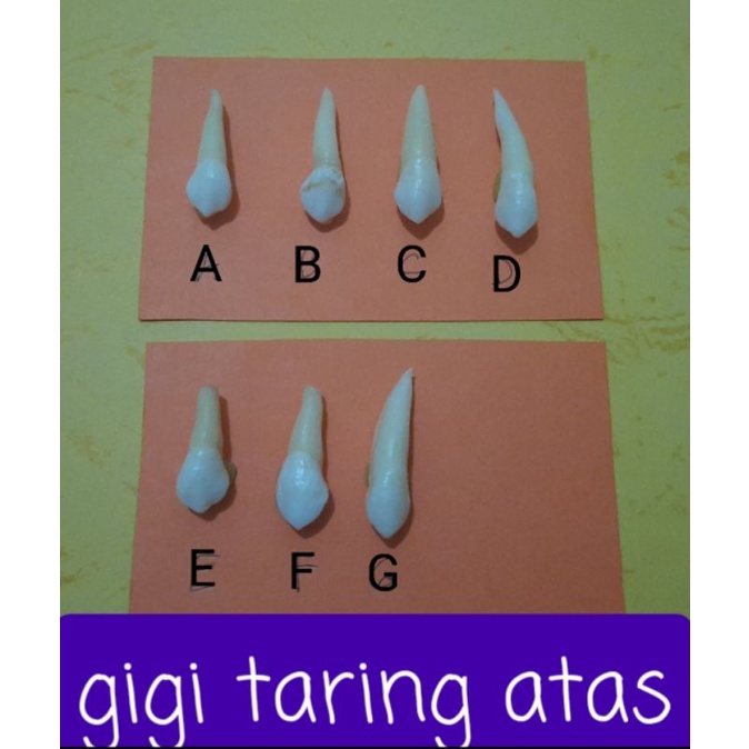 GIGI TARING ATAS/CANINUS/ gg ke 3 RA (gigi asli/praktikum kedokteran gigi)