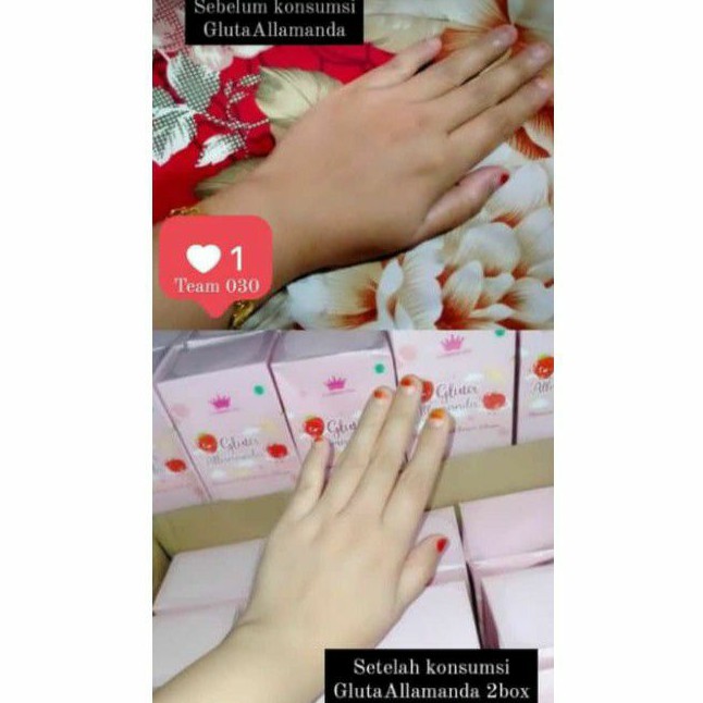 Gluta Allamanda Candy Stuff Collagen aman BPOM - 1 box setara 2x suntik putih