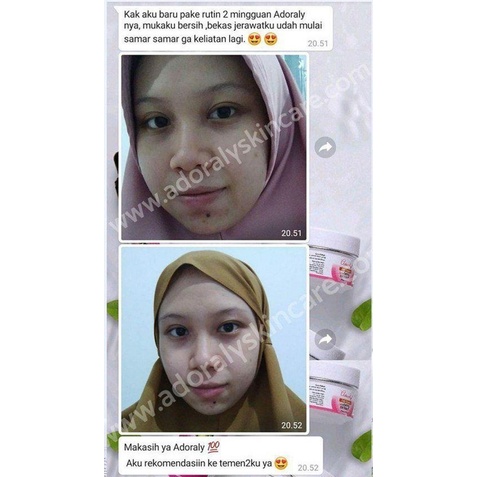BONUS POUCH - ADORALY SKINCARE BPOM, AMAN (1 PAKET GLOWING) _safa