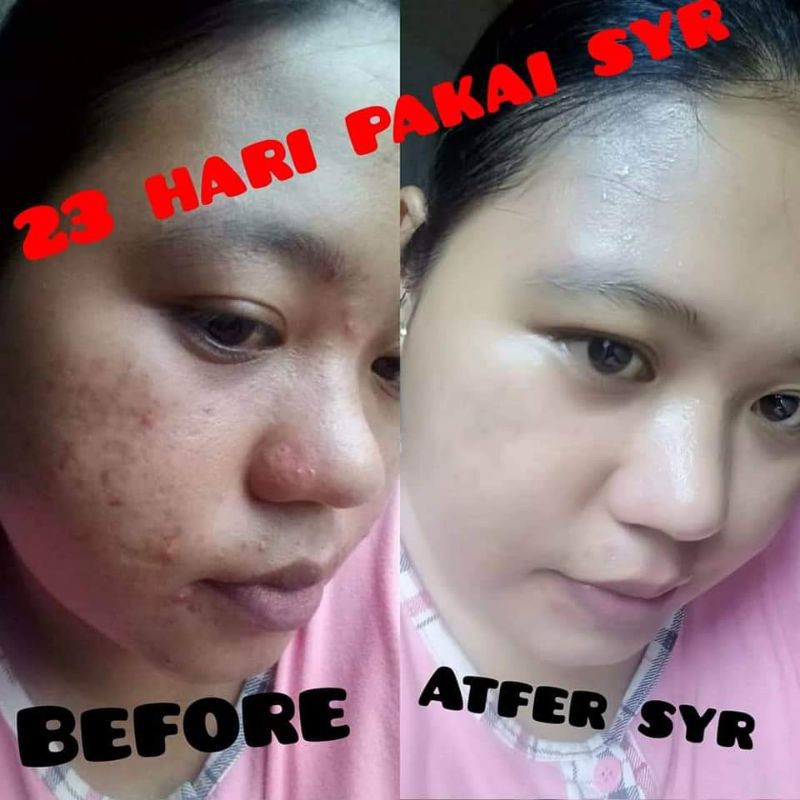 BISA COD BPOM Skincare Night Cream krim malam  syahreni glowing paket super syr syahraeni ori wajah-5