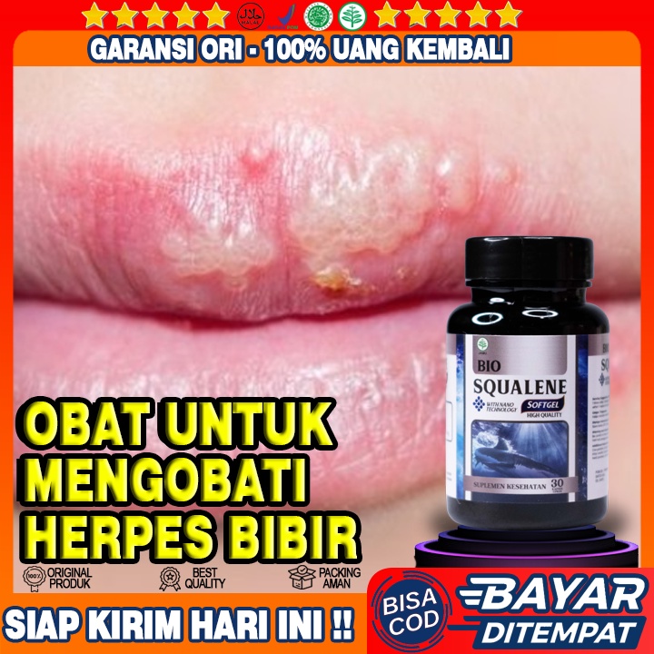 Obat Herpes Di Bibir - Obat Milia Di Hidung - Obat Milia Pada Wajah Milia Di Mata - Obat Herbal Mili