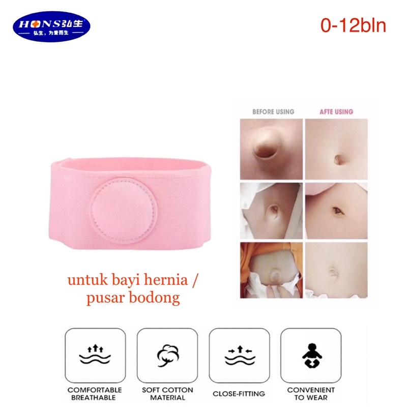 HONS Sabuk Hernia Perawatan Terapi / Sabuk Hernia Bayi  Infant Baby Umbilical Truss Belt Pusar Bodong