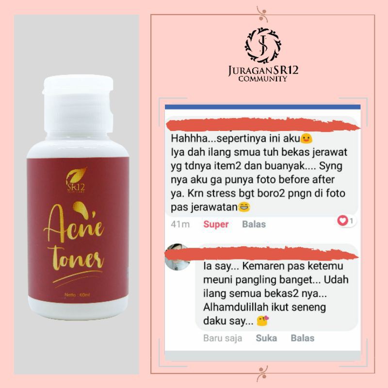 Acne Toner Premium SR12 Obat Jerawat Beruntus Regenerasi Kulit Mati Toner Jerawat Aman Ampuh BPOM