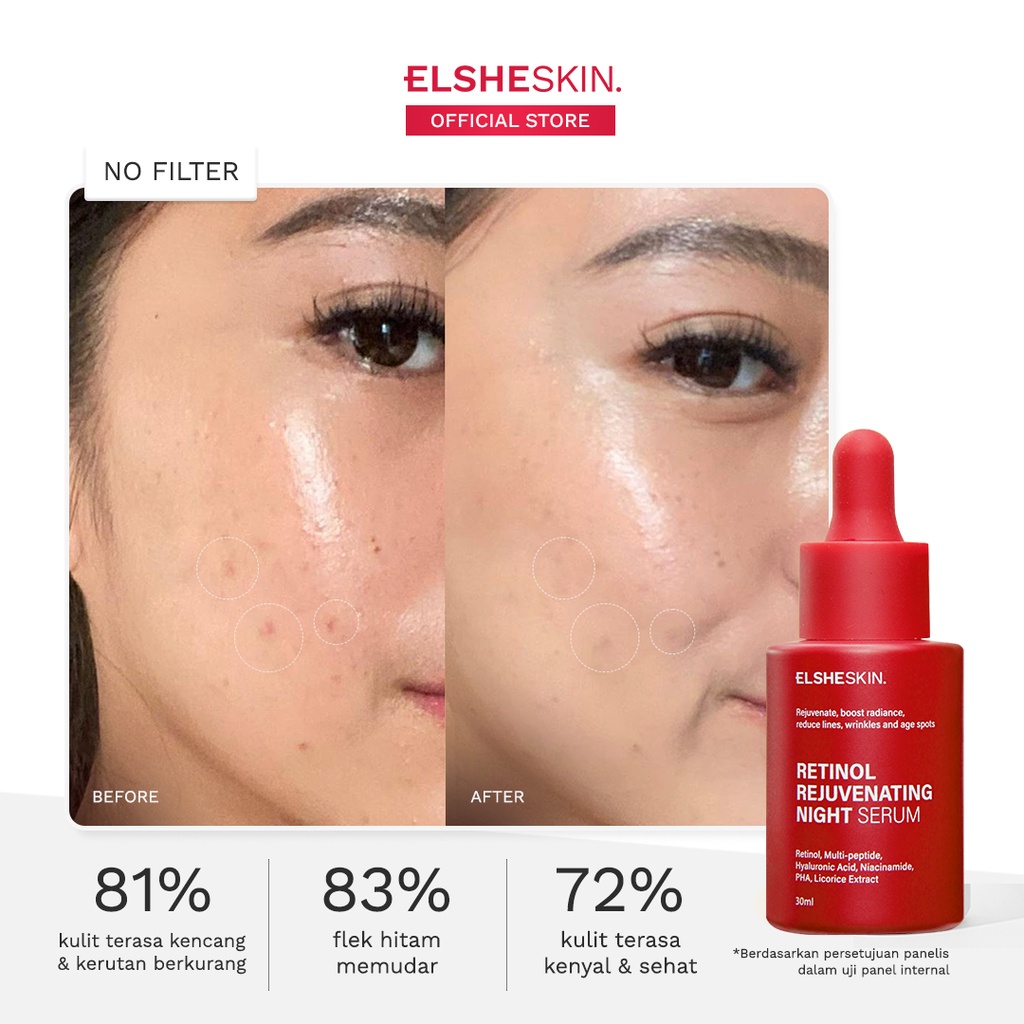 ELSHESKIN Retinol Rejuvenating Night Serum (Kulit Kenyal dalam 1 Malam) - Serum Anti Aging 15 ml / 30 ml