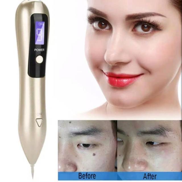 DARK SPOT REMOVAL DIGITAL PENGHILANG FLEK PENGHILANG BEKAS TATTOO KUTIL LASER PENGILANG BINTIK HITAM