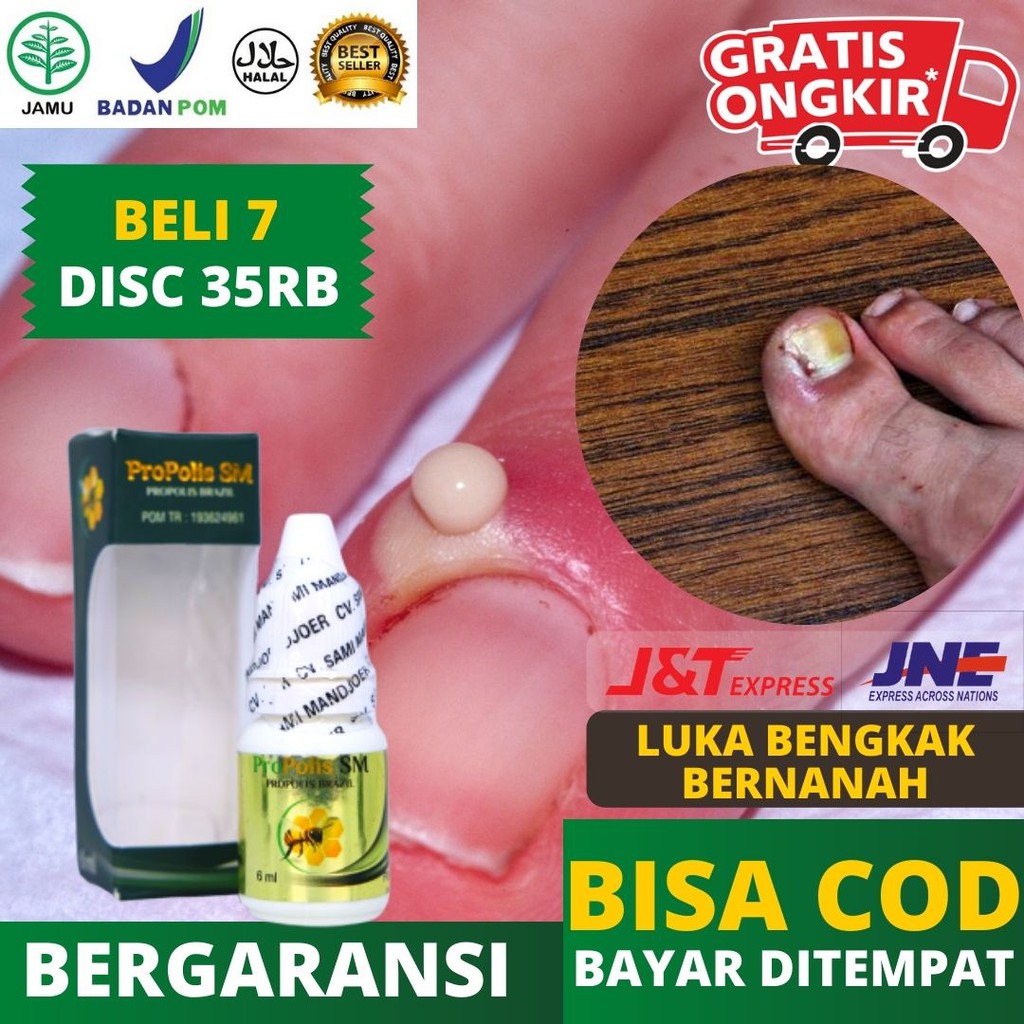 Harga Kaki Bengkak Bernanah Terbaru November 2021 Biggo Indonesia