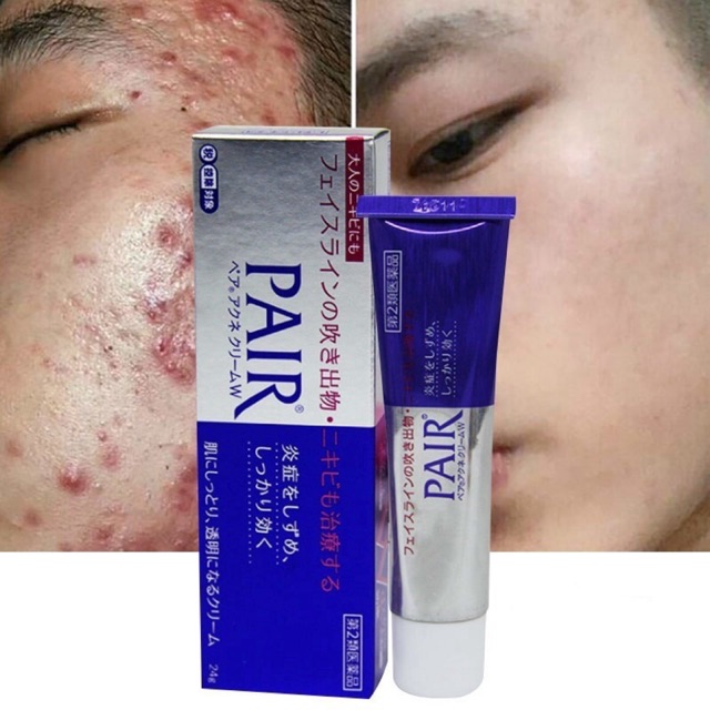 LION PAIR Acne Cream W 14g Antibacterial Acne Face Krim W Anti Jerawat