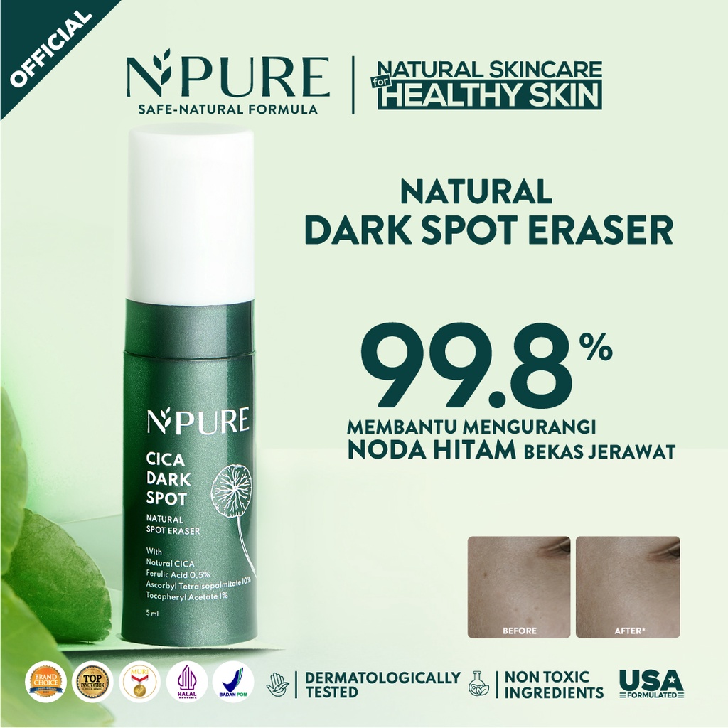 Jual NPURE SPOT TREATMENT ACNE SPOT/DARK SPOT | Shopee Indonesia