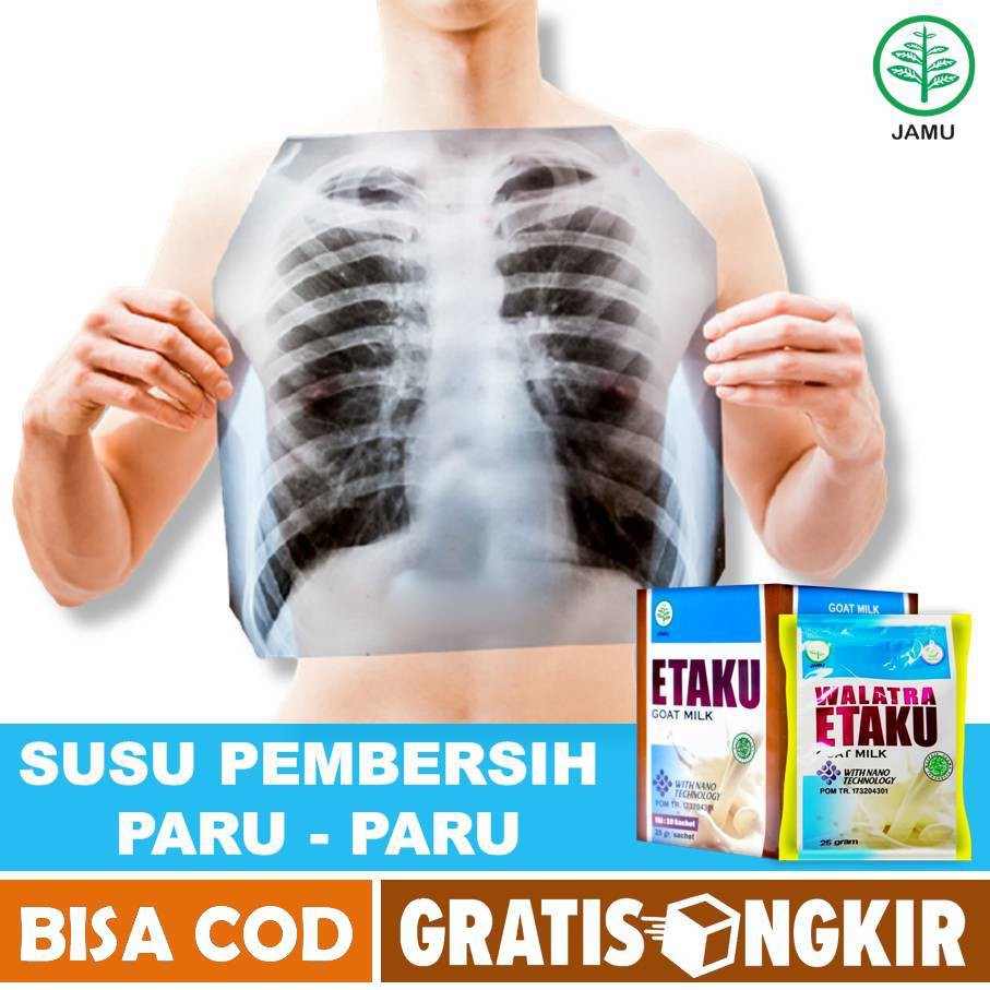 Jual Etaku Susu Pembersih Paru Paru Cairan Di Paru Paru Pembersih Paru Paru Perokok Flek 1257