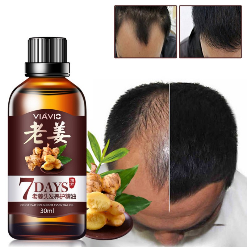 Cod Exo ღ Original Hair Growth Essence Conservation Ginger