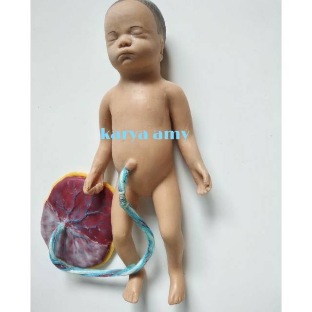 Phantom Bayi Placenta