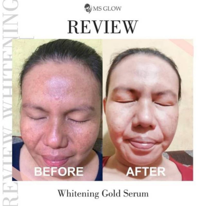 SERUM WHITENING GOLD ORIGINAL MS GLOW (SUDAH BER BARCODE TERBARU)