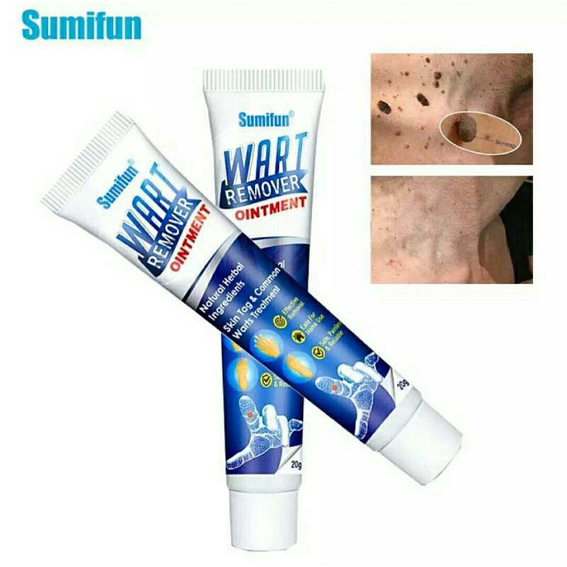 AD Skin tag Remover Krim Penghilang Kutil