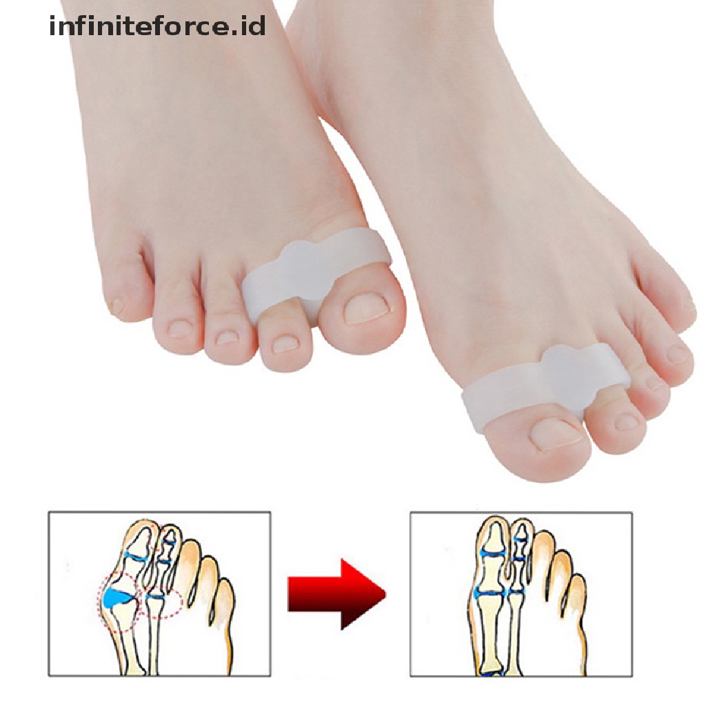 2 Pcs Korektor Pemisah Jari Kaki Hallux Valgus Bahan Silikon