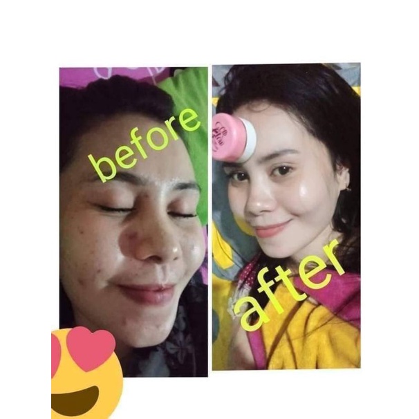 clbglow ORI