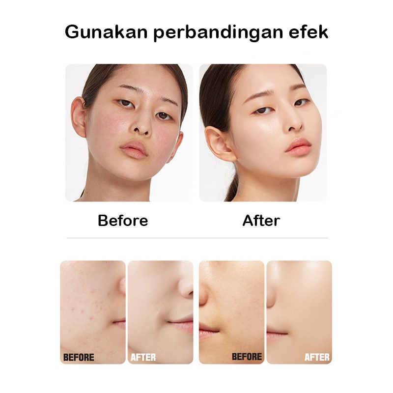 ☘️Garansi☘️ 8 in 1 hydra aqua dermabrasion peel hydrogen pdt mask oxygen rf wajah dermabrasion skin ultrasound detox rf setrika wajah dingin[100%ORI]