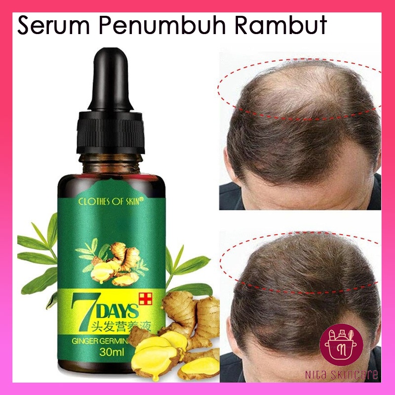 [COD] King Of Ginger Hair Serum Oil Original Penumbuh Rambut Anti Rontok 7 days Clothes of SKin