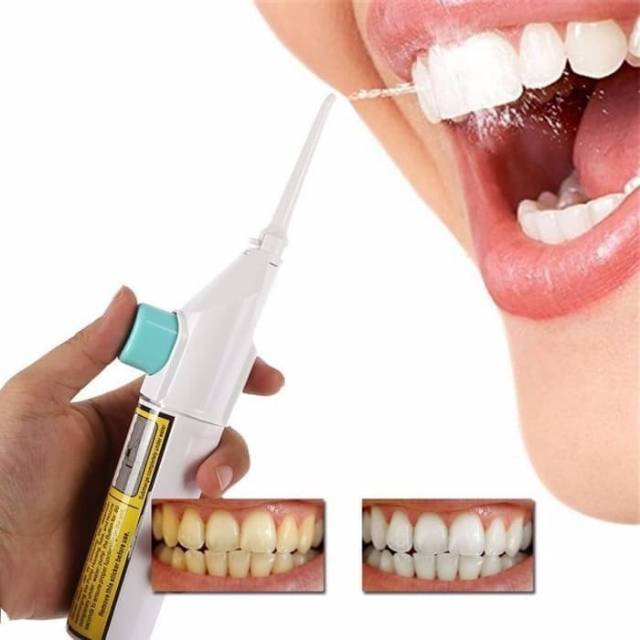 Portable Power Floss Dental Jet - Pembersih Karang gigi