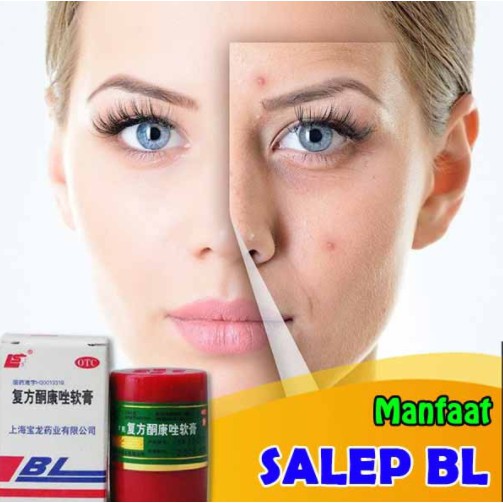 SALEP KULIT BL SHINSEI CHAN ORIGINAL