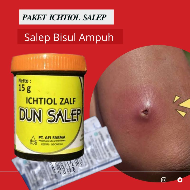 Icthtiol salep paket obat bisul ampuh