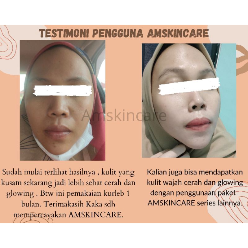 PAKET KULIT NORMAL BY AMSKINCARE | PUTIH GLOWING
