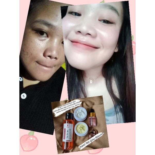 Paket flek+glow/paket susah putih Deswari skincare-1