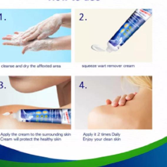 ☈ Wart Remover Ointment Skin Tag Remover Penghilang Tahi lalat ♬