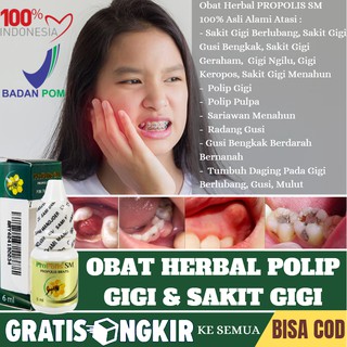 Jual Obat Herbal Sakit Gigi Berlubang, Polip Gigi Bernanah, Infeksi ...