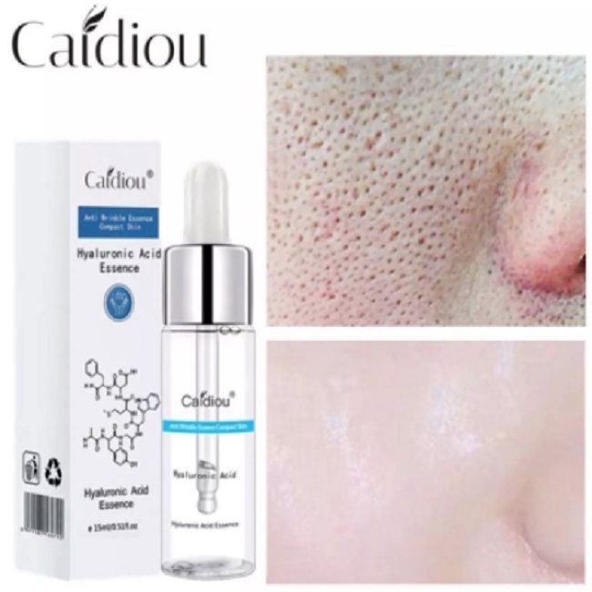 Serum Essence Anti Aging Perawatan Wajah Skin Care Caidiou