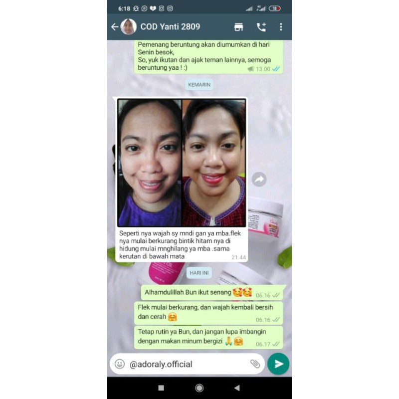 ADORALY SKINCARE ORIGINAL - SKINCARE GLOWING JAKARTA FREE HADIAH-4