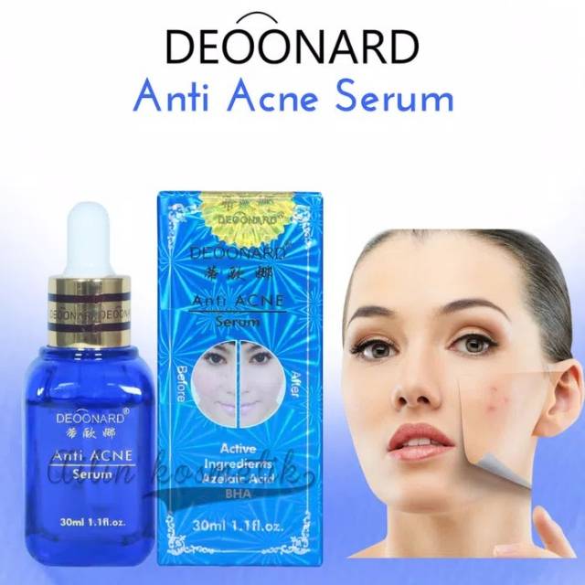 Serum deonard Anti acne original