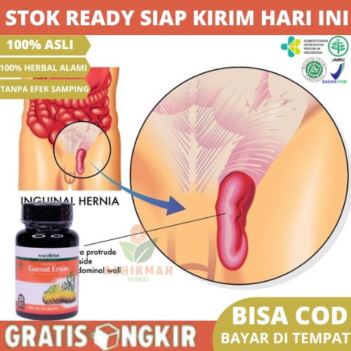 Obat Hernia, Obat Turun Berok Untuk Dewasa, Obat Hernia Pria Dewasa, Obat Turun Berok Pria, Obat Her