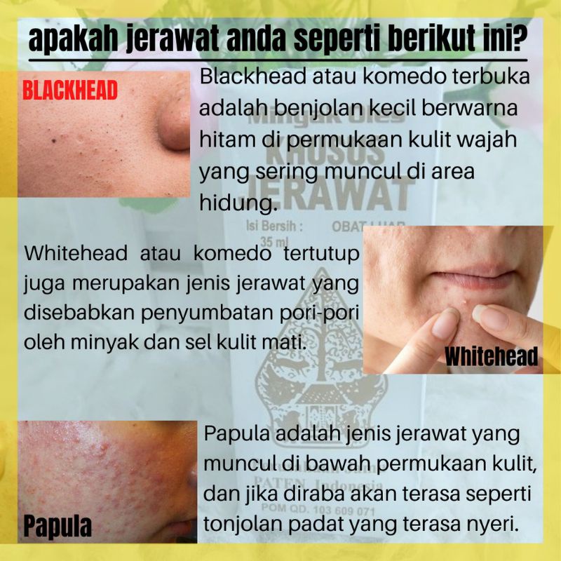 OBAT JERAWAT WAYANG BPOM