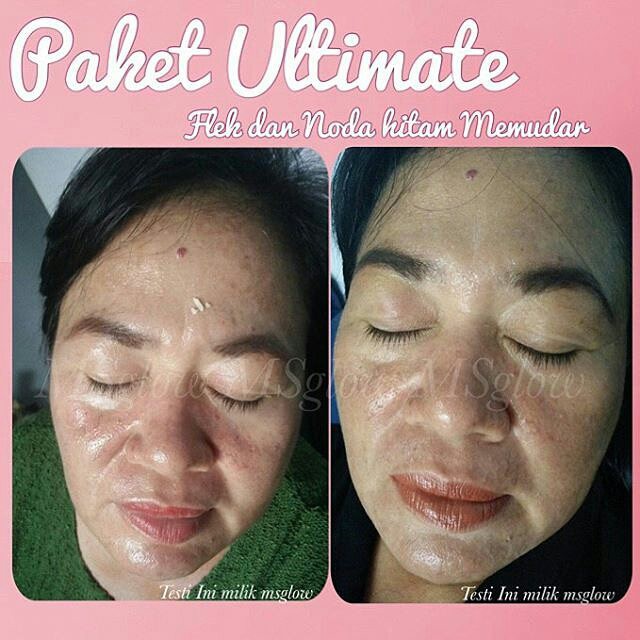 MS Glow Paket Ultimate Original Perawatan Wajah Glowing Menyamarkan Kerutan & Keriput BPOM Bisa COD-1