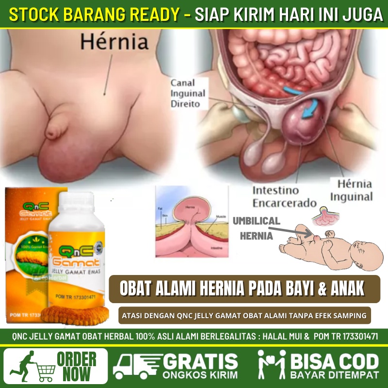 Obat Benjolan Hernia di Tubuh 100% Alami Cocok Untuk Bayi & Anak, Obat Hernia Pada Bayi, Benjolan di