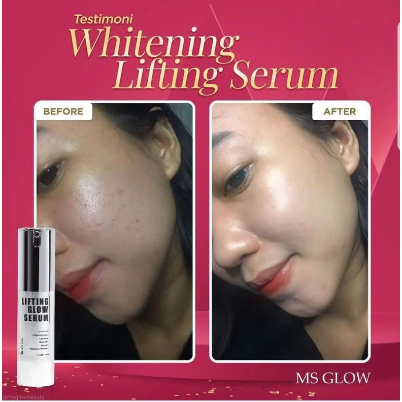 Lifting Whitening Serum 15 ml MS GLOW