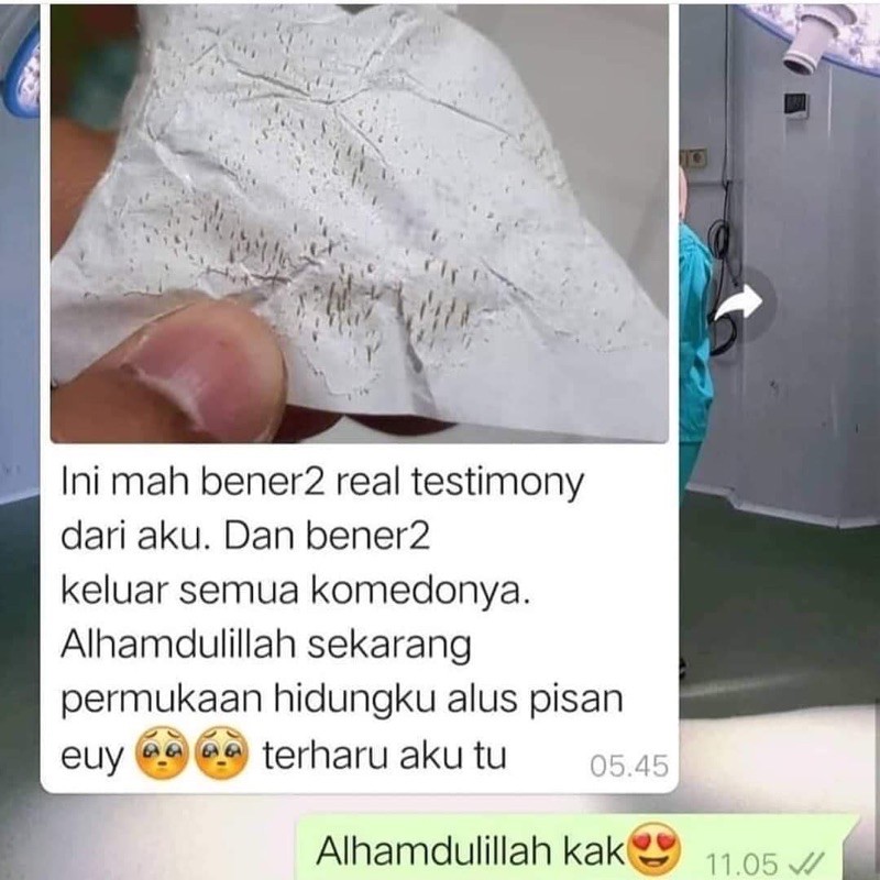 ORIGINAL HUT MUN GEL PENGHILANG PEMBERSIH KOMEDO AMPUH BEHELLDENTAL - GEL MAT NA HUT MUN WHITE . GELMATNA HUTMUN . ALAT PENGHILANG PENCABUT KOMEDO BEHELLDENTAL