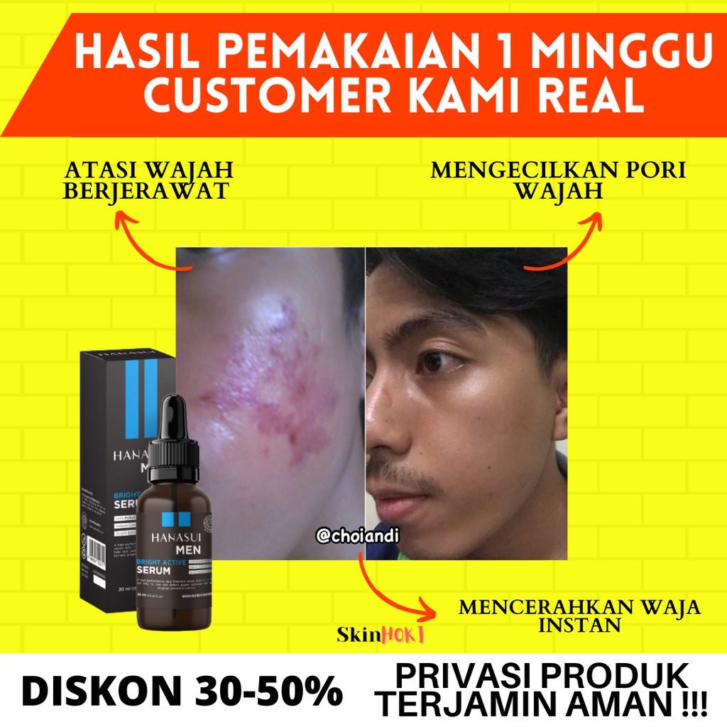 SERUM WAJAH PRIA PENGHILANG JERAWAT PRIA SERUM HANASUI MEN BRIGHT ACTIVE SERUM 20ML SERUM PEMUTIH WAJAH ORIGINAL BPOM