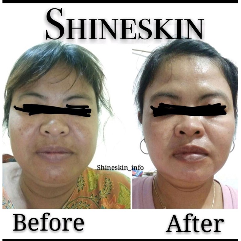 Shineskin LIGHTENING Whitening 1 NIGHT CREAM (L1) ORIGINAL (KEMASAN BARU) Ndk78