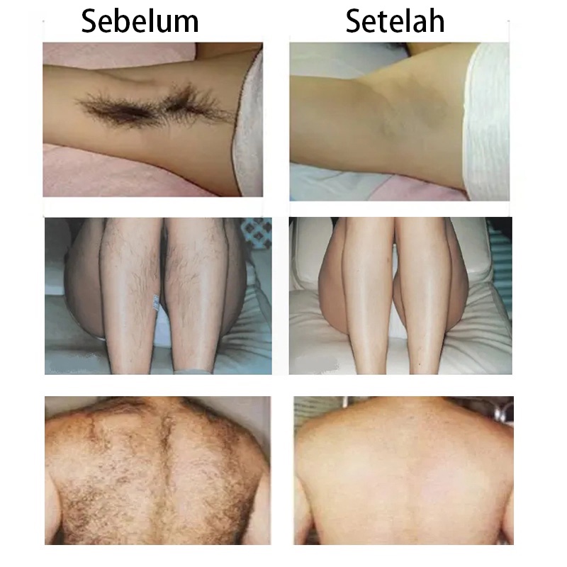 Spray Penghilang Rambut Hair Removal Krim Pemutih Dan Penghilang Rambut Hair Removal Wax 120ml Spray Busa Menghambat Pertumbuhan Rambut Alat Penghilang Bulu Dengan Lembut Tanpa Rasa Sakit Untuk Bagian Pribadi, Tangan Dan Kaki