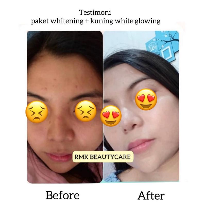 paket whitening BOOSTER / SENSITIF cream pemutih kulit kebal susah putih rmk / cream pemutih wajah kusam kering / kusam berminyak