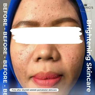PAKET Pencerah Kulit Kusam BRIGHTENING BENING’S SKINCARE BY Dr.OKY
