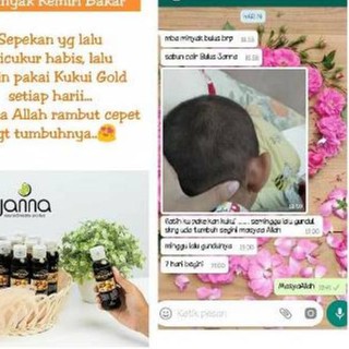 Manjur Penumbuh Dan Penyubur Rambut Herbal Minyak Kemiri Kukui Gold Shopee Indonesia